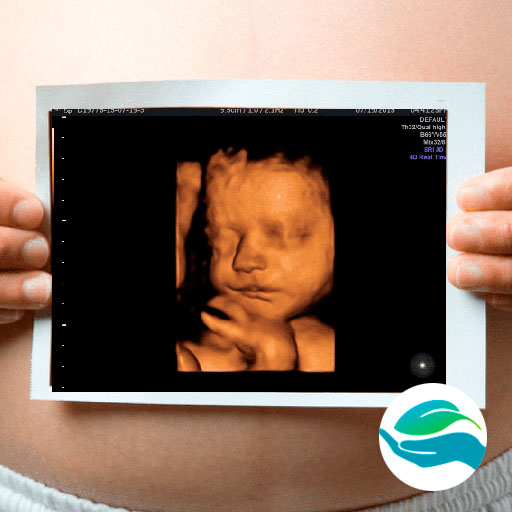 УЗИ обследование беременных 3D, 4D